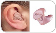 in the ear hearing aid