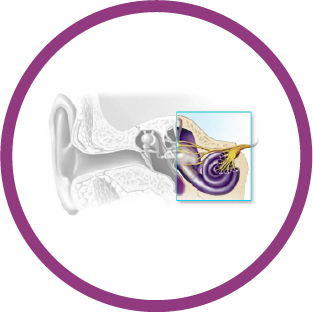 sensorineural-hearing-loss
